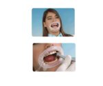 OPTRAGATE reposicion regular 80 ud