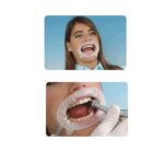 OPTRAGATE reposicion regular 80 ud