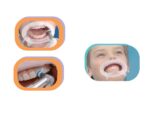 OPTRAGATE reposicion pequeño 80 ud