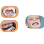 OPTRAGATE reposicion pequeño 80 ud
