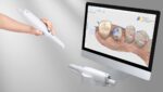 Escaner intraoral Medit i900 - Imagen 2