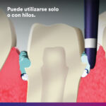 PASTA RETRACCIÓN ARP 25 UNIDADES - Imagen 2