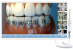 CAMARA INTRAORAL CON AUTOFOCUS Y ACOPLE BRAZO - Imagen 2