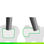 FILTEK ONE Jeringa 4 g - Imagen 5