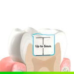 FILTEK ONE Jeringa 4 g - Imagen 6
